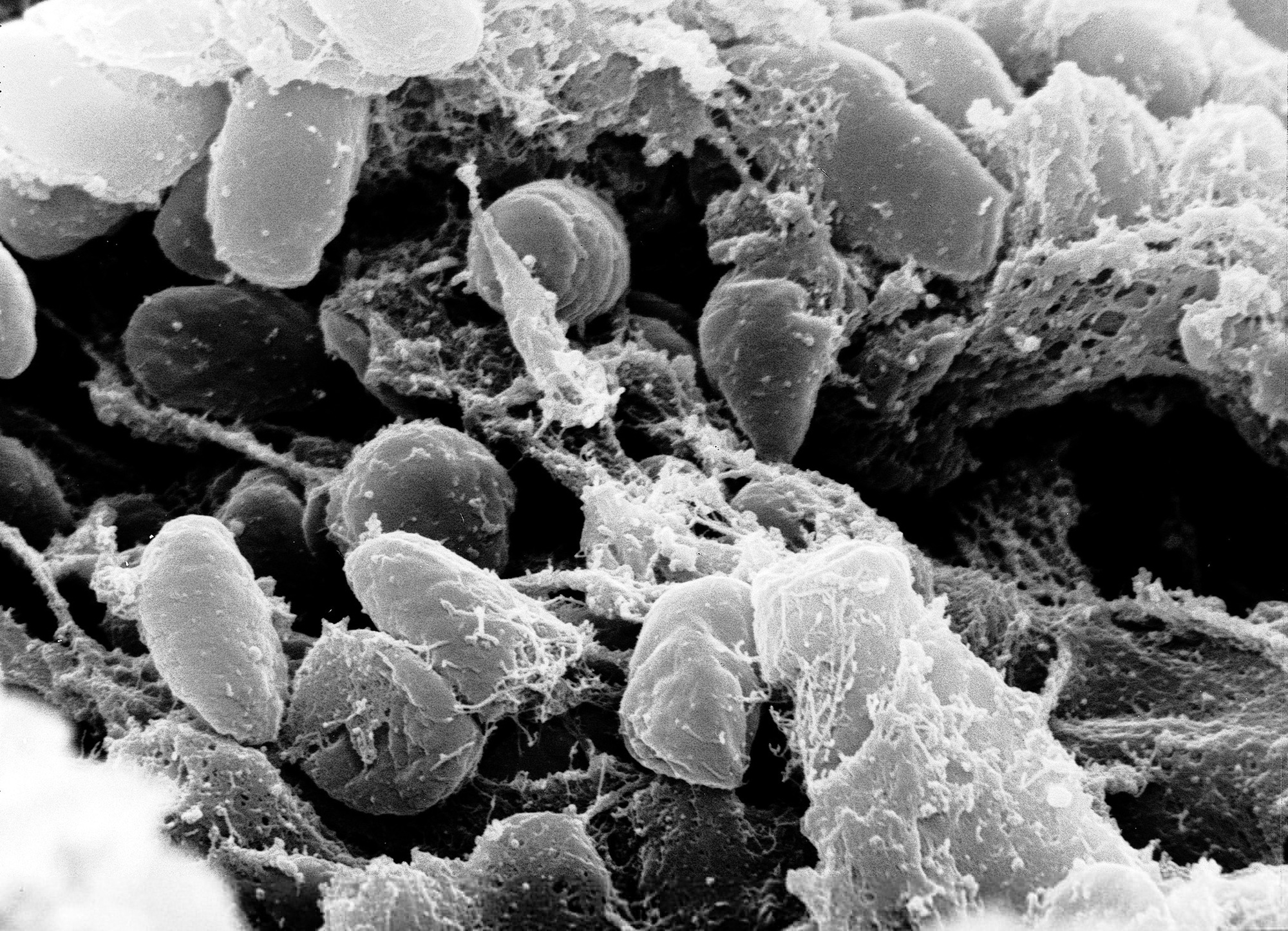 Scanning electron micrograph of Yersinia pestis